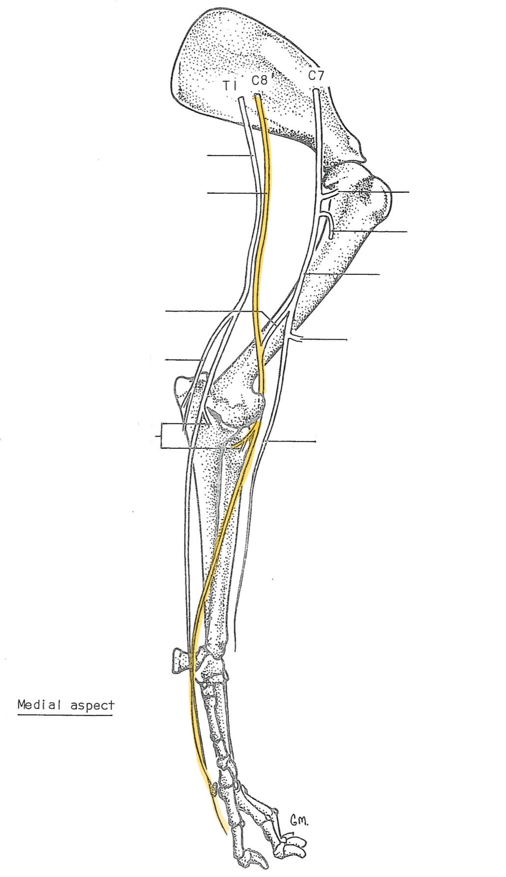<p>originates from C8-T1</p><p>innervates:</p><ul><li><p>carpus &amp; digit flexors</p><ul><li><p>pronator teres</p></li><li><p>flexor carpi radialis</p></li><li><p>superficial digital flexor</p></li><li><p>deep digital flexor</p></li></ul></li><li><p>skin caudal antebrachium &amp; palmar manus</p></li></ul><p></p>