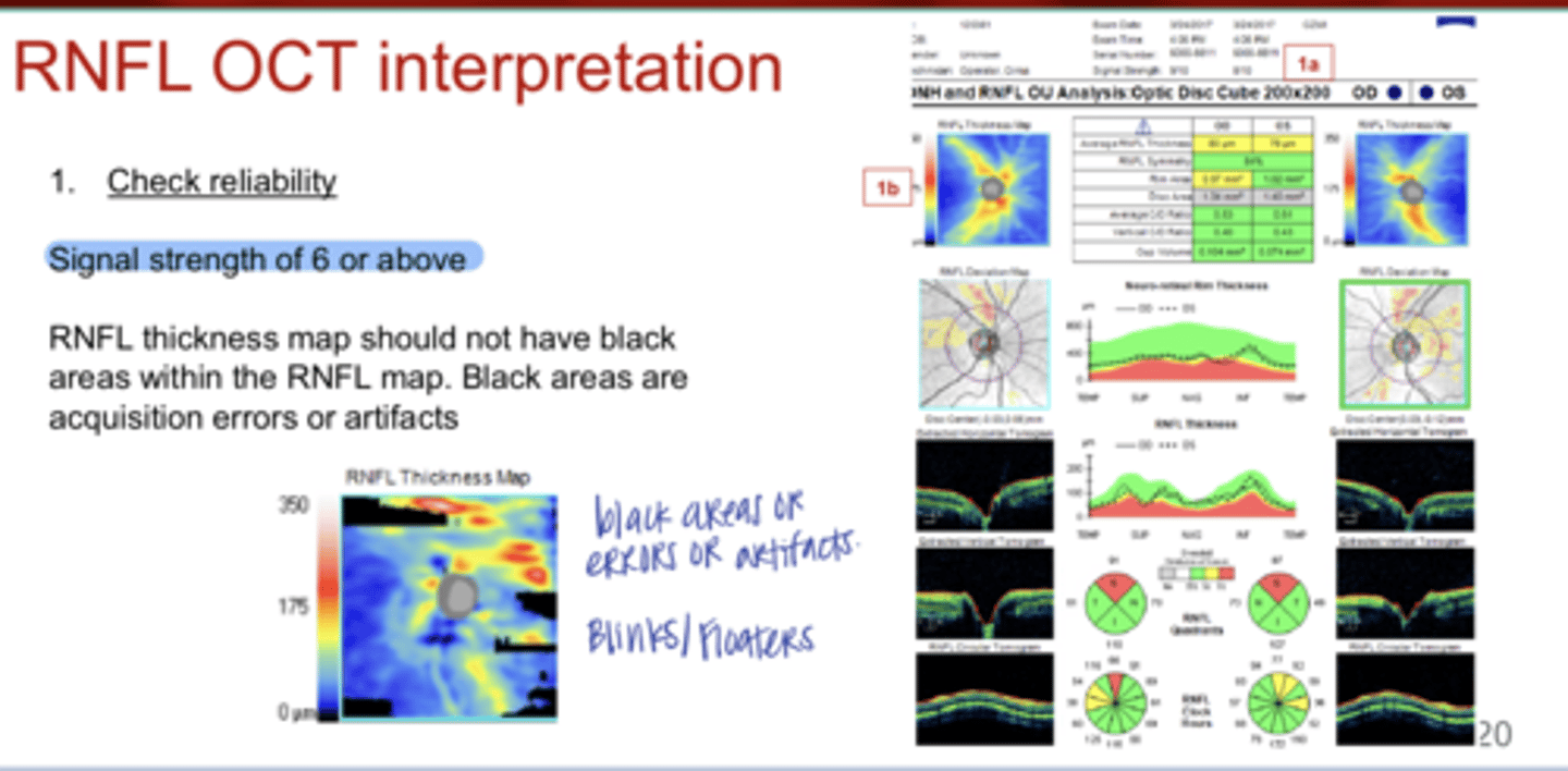 <p>What could black areas in the OCT RNFL thickness map indicate?</p>