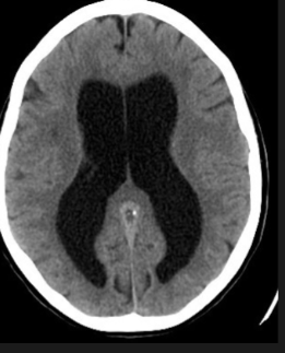 <p>what is the diagnosis?</p>