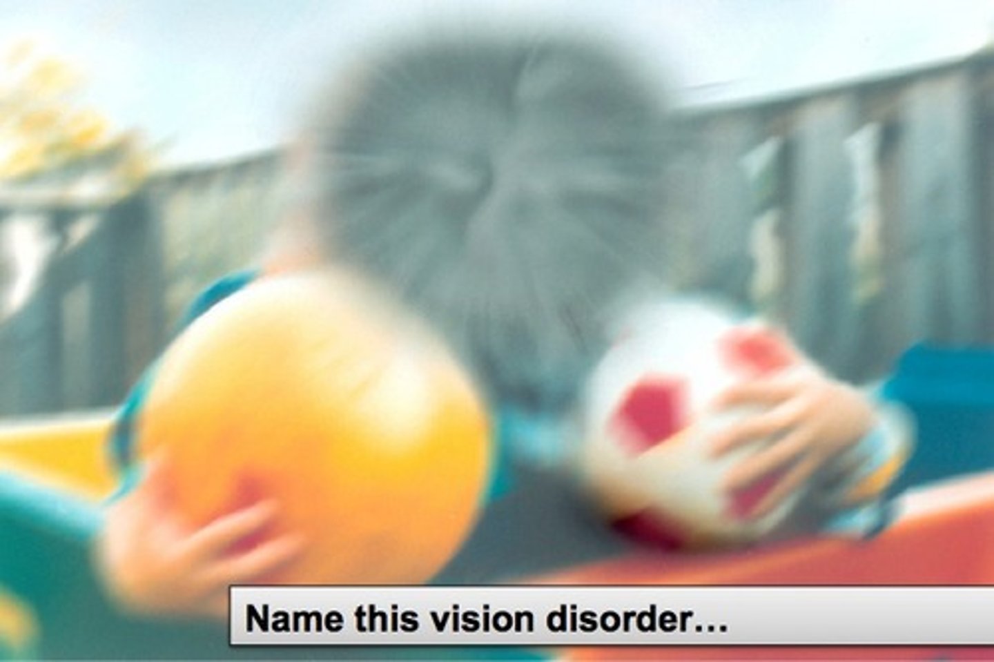 <p>central vision lost</p>
