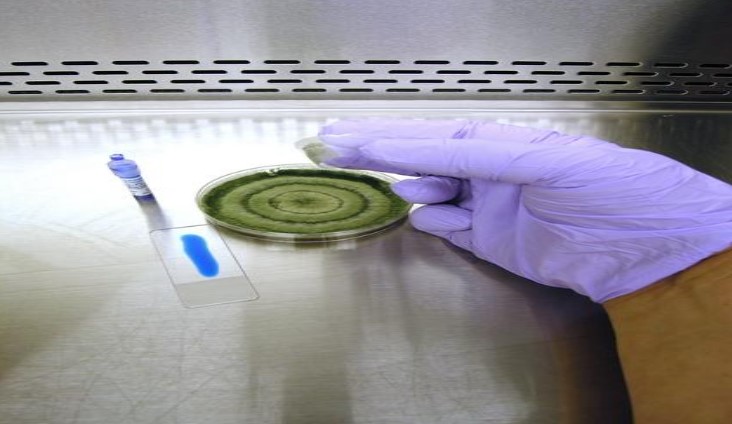<p>Name of test and dye</p>