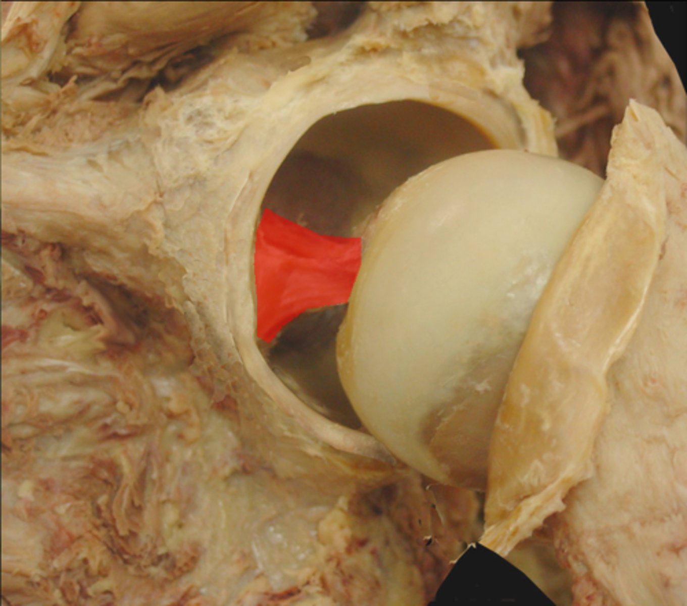 <p>ligament that spans the acetabulum of the hip bone and the fovea capitis of the femoral head</p><p>allows pathway for small artery</p>