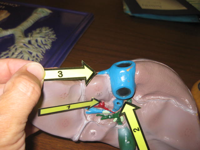 <p>Identify The Vessel 1, 2 and 3?</p><p>Lab Image 3-13</p>