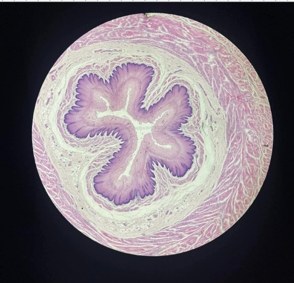 <p>What specimen is this and what is the tissue type?</p>