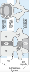 <p>- Three columns of stability to the spine</p><p>- Theory that an injury to 2 or more columns dictates an unstable injury and thus likely requires surgical fixation</p>