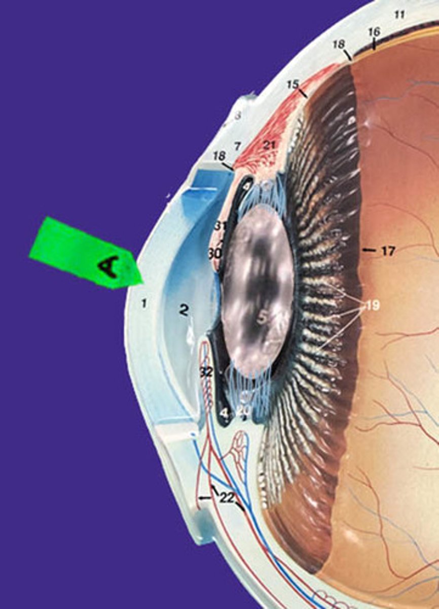 <p>Identify this transparent structure.</p>