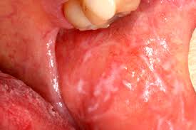 <p>What diagnosis is this?</p>