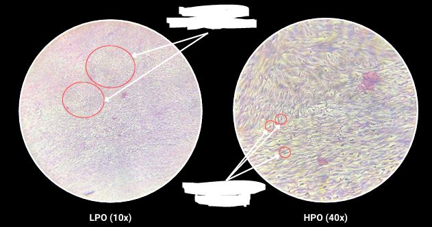 <p>What are the arrows pointing?</p>