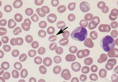 <p>Causes RBCs to become Stomatocytes</p>