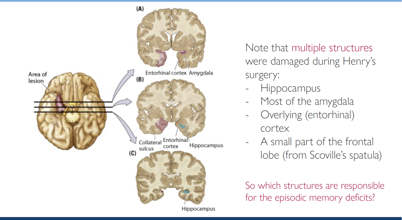 <ul><li><p>trying to identify the <strong>particular regions</strong> within the medial temporal lobe that were critical for memory function</p></li></ul><p></p>
