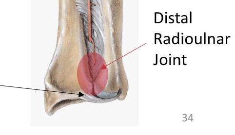 <p>fibrocartilage disc that connects ulnar head with ulnar notch of radius</p>