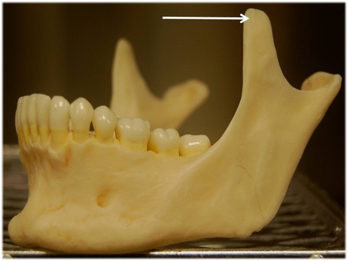 <p>ID structure at tip of arrow</p>