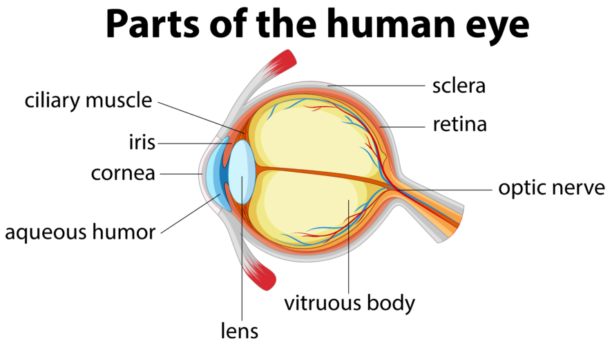 <p>How is the Aqueous humor made: ;</p><p>step 1: ciliary body epithelial cells actively secrete Na and bicarbonate</p><p>step 2: osmotic gradient is formed</p><p>step 3: pulls water from the ciliary stromal ultrafiltrate</p><p>step 4: puts water into the posterior chamber of the anterior cavity </p><p>step 5:</p>