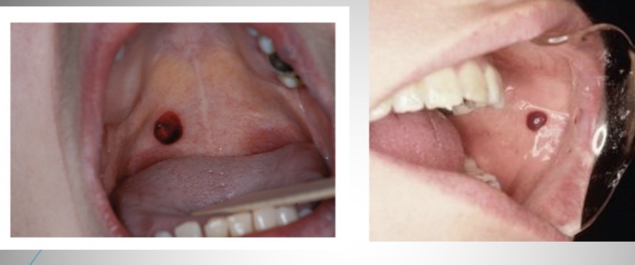 <p>What is this condition?</p>