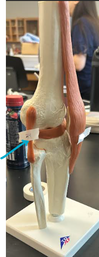 <p>ID knee joint region </p>