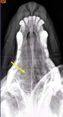 <p>What is this being used to diagnose, where there is loss of nasal turbinates, increase in soft tissue density, but NO lysis or deviation of the vomer or frontal bones (typically)</p>