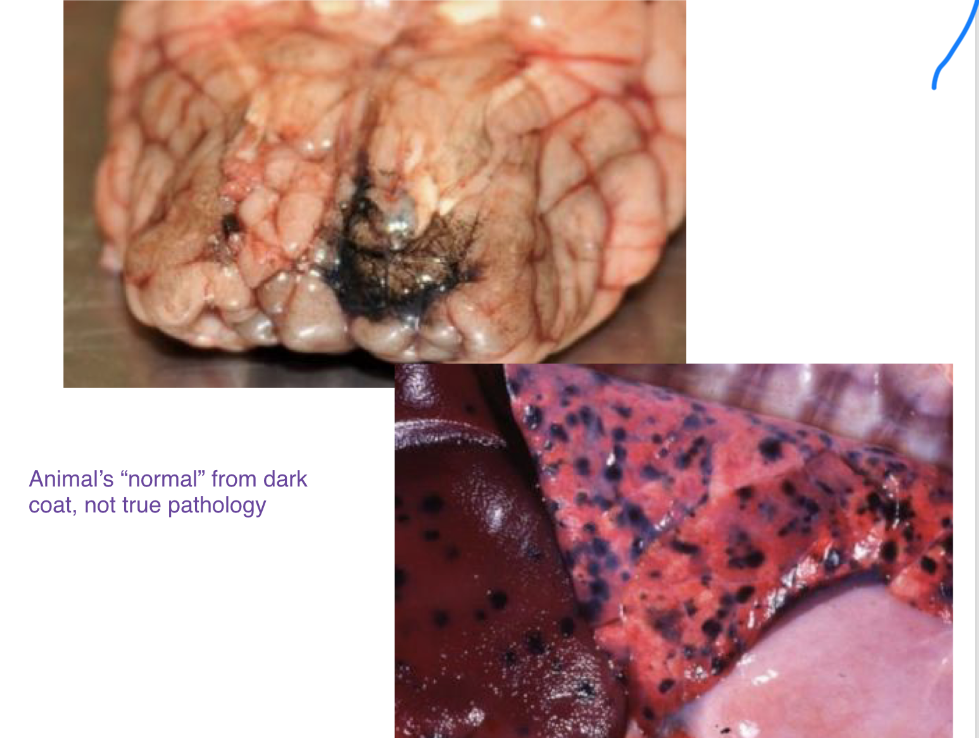 <p>what is melanosis </p>