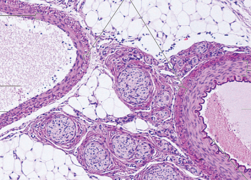 <p>label from left down then right down then top center</p><p>word bank: </p><p>tunica media of vein</p><p>tunica externa</p><p>lumen of artery</p><p>lumen of vein</p><p>tunica intima</p><p>tunica intima</p><p>tunica media of artery</p>