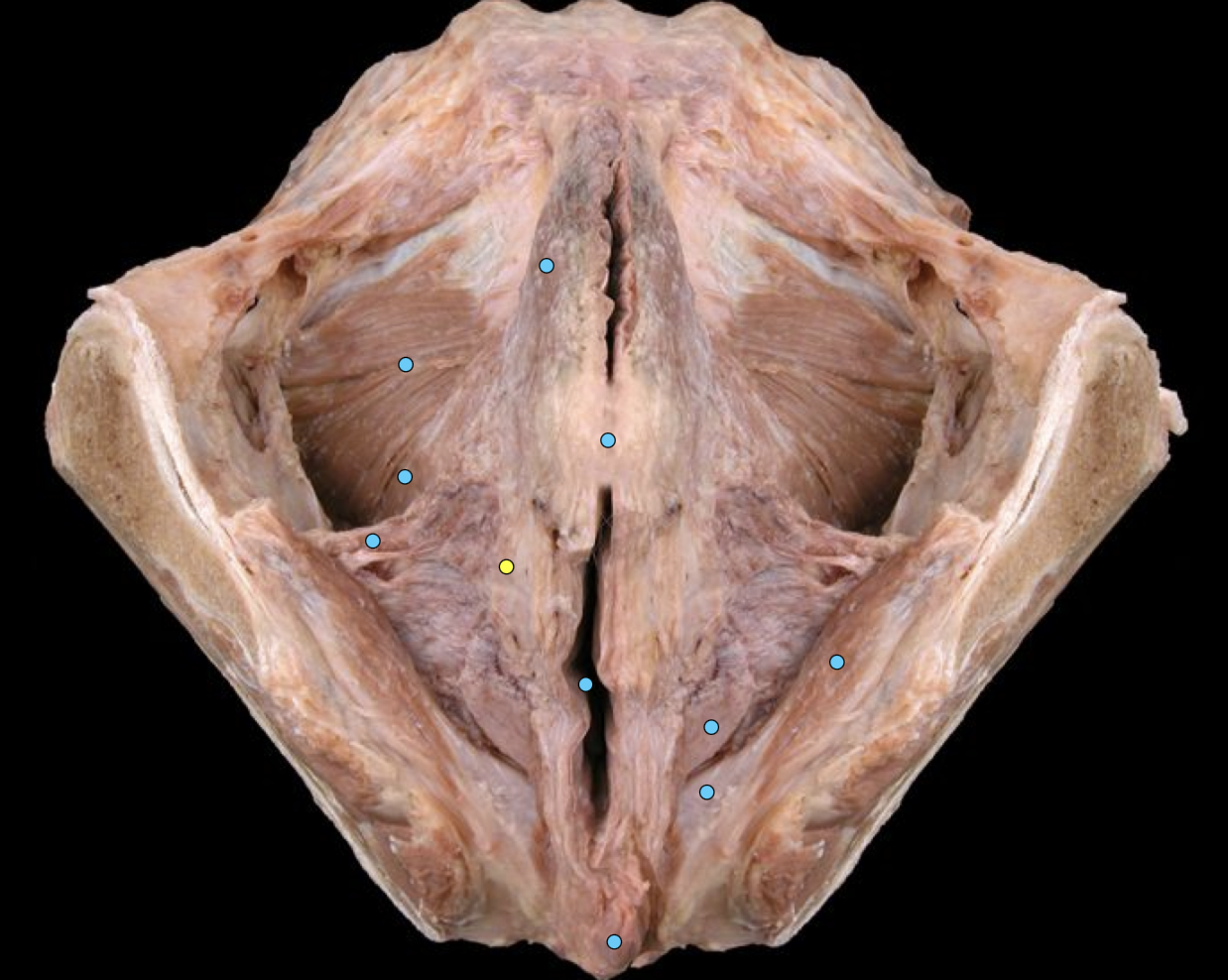 term image