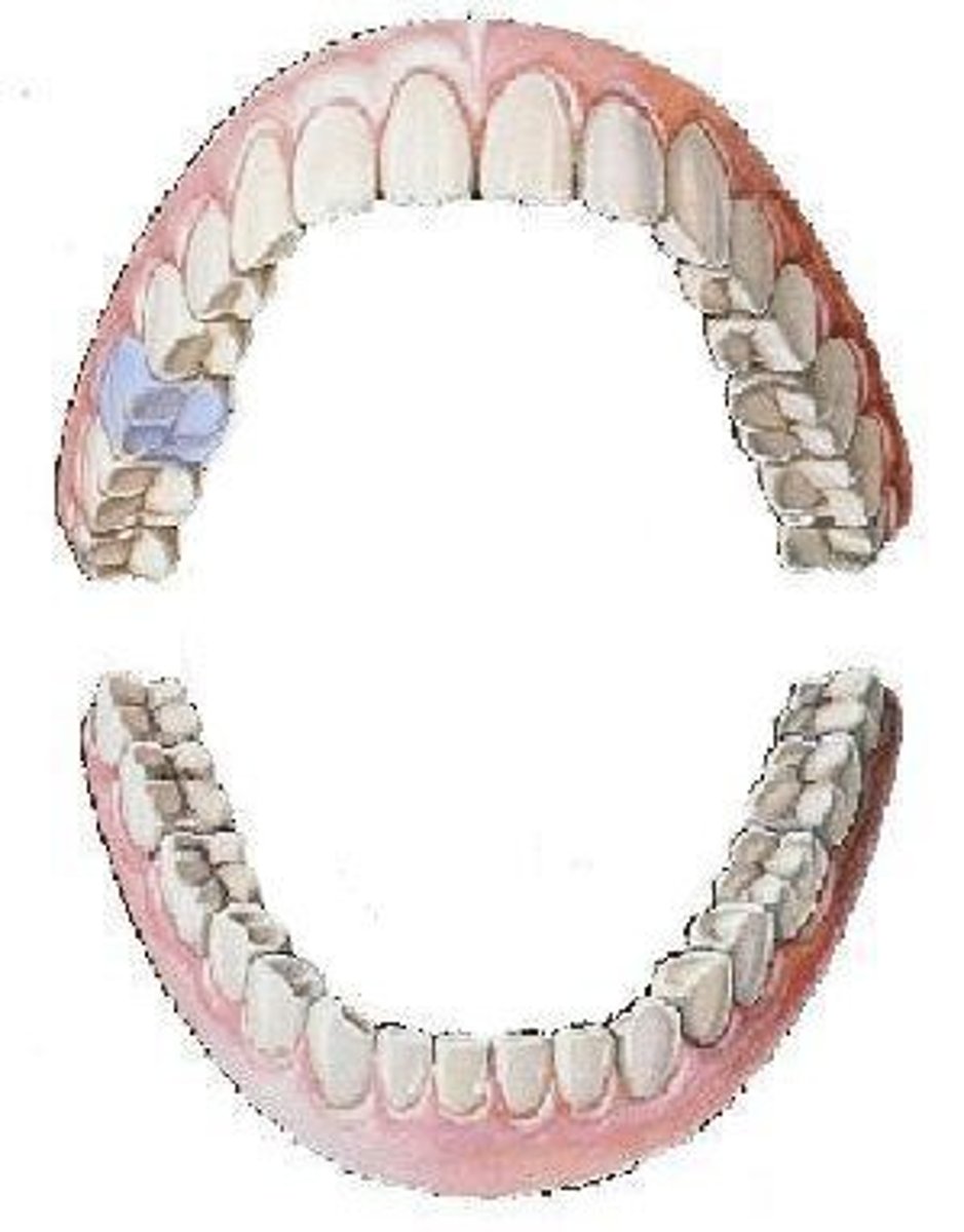 <p>maxillary right first molar</p>