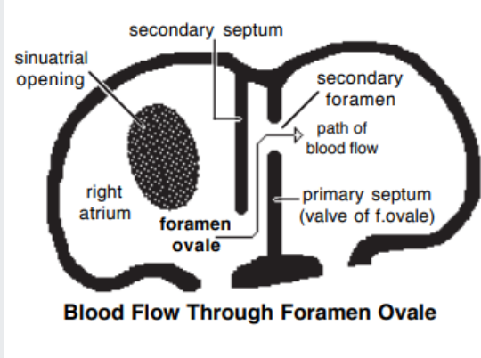 <p>A <span style="color: purple;">membranous fold (primary septum) grows down from the dorsal wall of the atriu</span>m towards the endocardial cushions</p><p></p><p>Divides atrium into <span style="color: purple;">left and right atria</span></p><p></p><p><strong>Primary septum</strong> leaves a small hole near the cushions, that will eventually close (p<span style="color: purple;">rimary forame</span>n)</p><p></p><p>Before it closes, a second hole forms in the <strong>primary septum</strong> via a<span style="color: purple;">poptosis (secondary forame</span>n)</p><p></p><p>Secondary septum grows from the cranial wall of the right atrium toward the caudal wall</p><p></p><p>The septum remains incomplete, and its free edge forms the boundary of an opening called the<strong> </strong><span style="color: purple;"><strong>Foramen Ovale</strong>*</span>-left foramen ovale (oval shaped)</p><p></p><p>Asnwer to Q: Primary septum acts like a valve against the muscular secondary septum</p><p>• A shunt that allows oxygenated blood to bypass the nonfunctional fetal lungs to continue blood flow and allow oxygenated blood reaching the foetal heart</p>