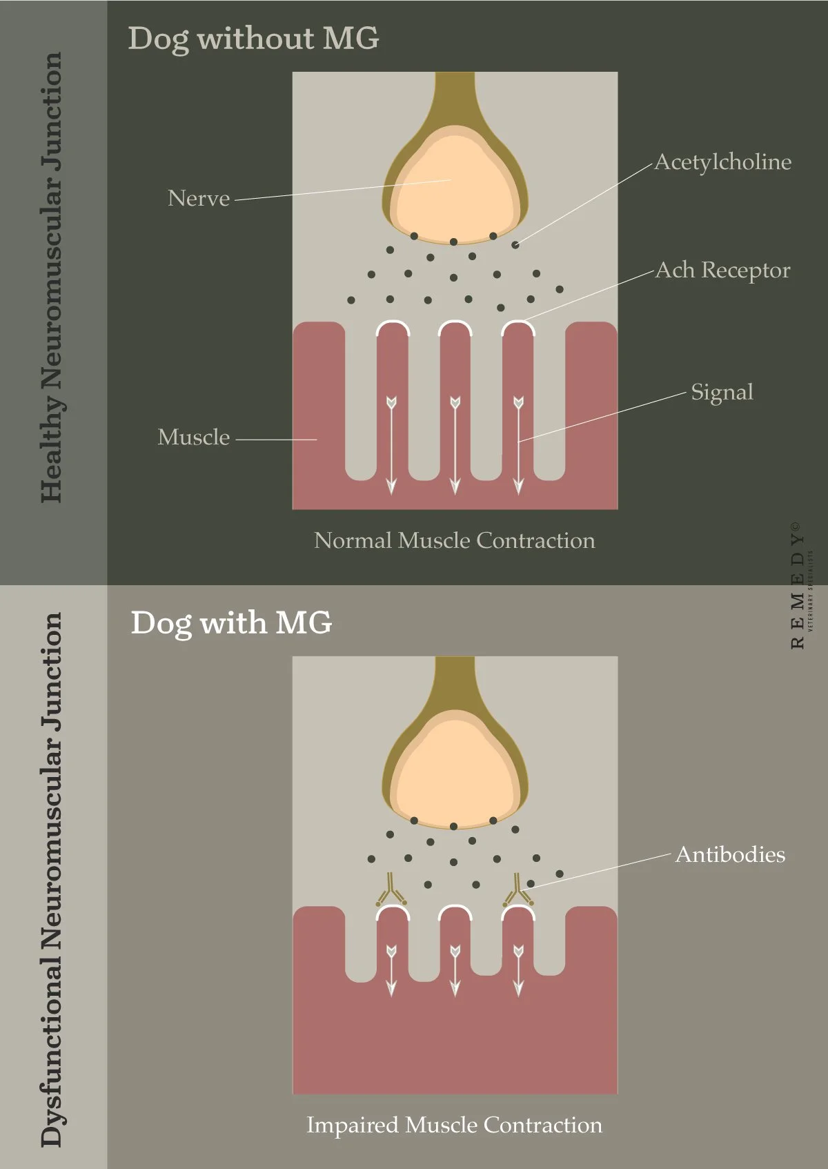 <p>Acetylcholine receptor antibody test</p>