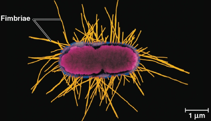 <p>Fimbriae</p>