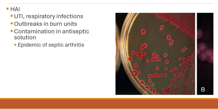 <p>Serratia marcescens</p>