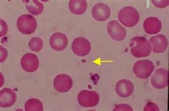 <p>cell fragments that help blood to clot after an injury.</p>