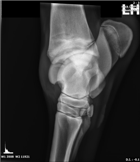 <p>AKP store husdyr blok 4 2024</p><p>På dette røntgenbillede findes osteochondrose på et prædilektionssted i talocruralleddet hos hest. Hvilke andre prædilektionssteder for osteochondrose i talocruralleddet hos hest findes der?</p><p>1 Laterale trochlea, mediale malleol </p><p>2 Distale intermediærkam af tibia, laterale trochlea </p><p>3 Mediale kondyl, mediale malleol </p><p>4 Tuberositas tibia, distale intermediærkam</p>