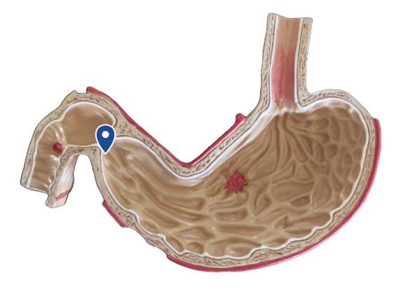 <p>Name this opening.</p>