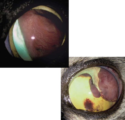 <ul><li><p>cell of origin: pigmented or nonpigmented <strong>ciliary body epithelium</strong></p></li><li><p>common in dogs, less common in cats</p></li><li><p>biologic behavior</p><ul><li><p><strong>vast majority benign</strong> = iridociliary adenomas</p></li><li><p><strong>scleral invasion</strong>: iridociliary adenocarcinoma</p></li></ul></li></ul><p></p>