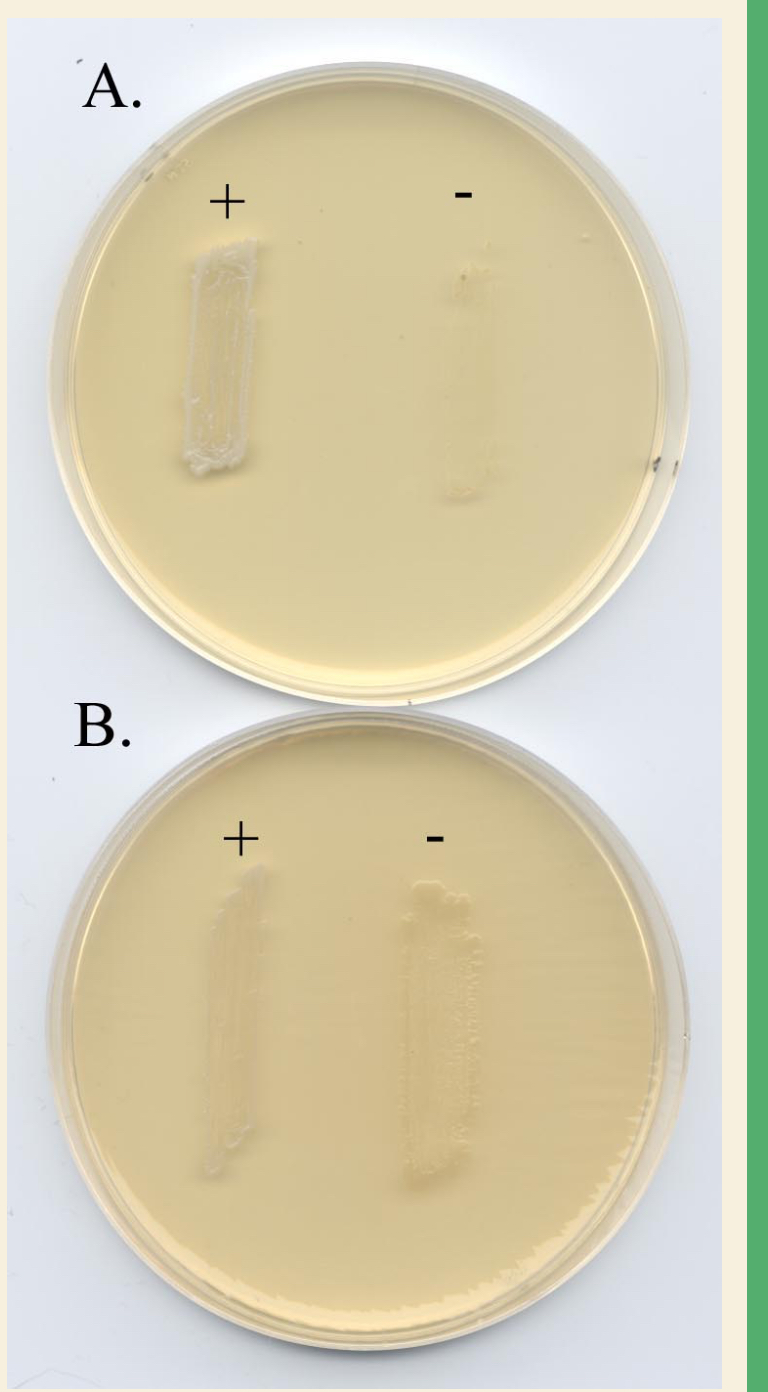 <p>Is B-Phenylethyl Alcohol (PEA) defined or undefined? Is it selective, </p><p>differential, or both? </p>