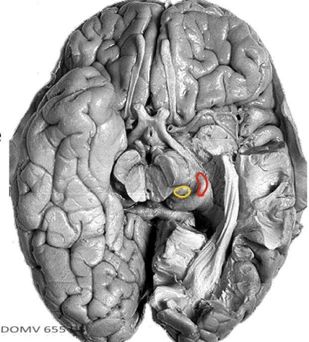 <p>Lateral and medial geniculate bodies constitutes the metathalmaus  and may be considered as the caudal continuation of the ventral nuclear mass of the thalamus. </p>