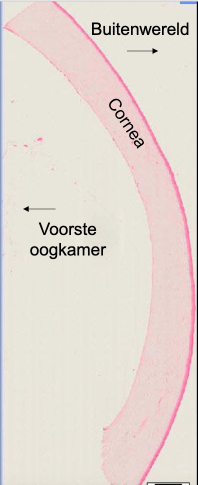 term image