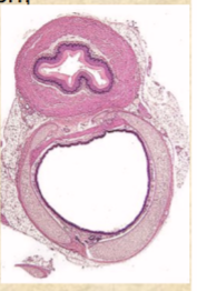 <p>straight muscular tube 25-30 cm long</p><ul><li><p>connects pharynx to cardiac orifice of stomach</p></li><li><p>stratified squamous epithelium</p></li></ul><p></p>