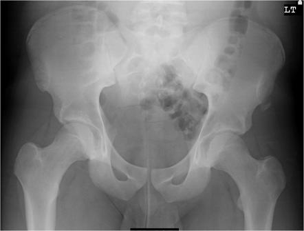 <p>What is the diagnosis?</p>