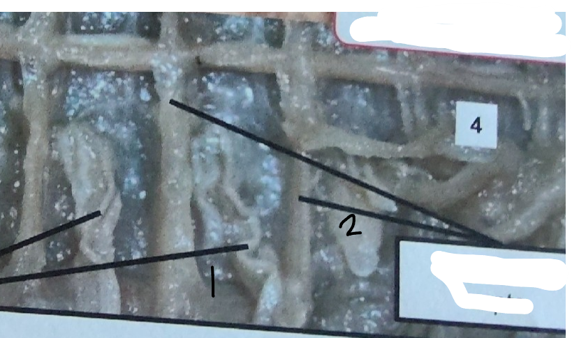 <p>What is point 1 on this earthworm</p>