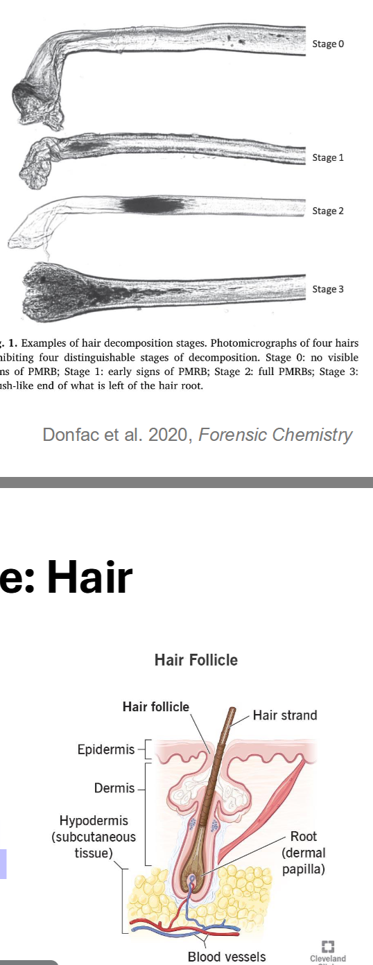 <p>Major types of trace evidence: Hair</p>