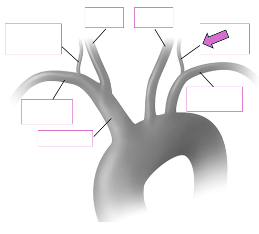 <p>Based on the indicated area, identify this vessel</p>