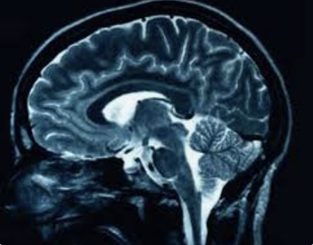 <p>Point to where the cerebellum is</p>