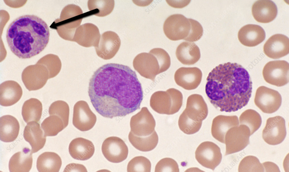 <p><span><strong>Identify the blood cell indicated by the pointer.</strong></span></p>