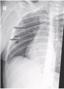 <p><span style="background-color: transparent;">attempt at AP ribs</span></p>