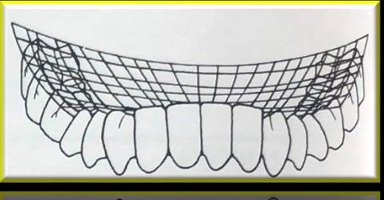 <p>-combines the spee and wilson curves with the curve of the incisal edges</p>