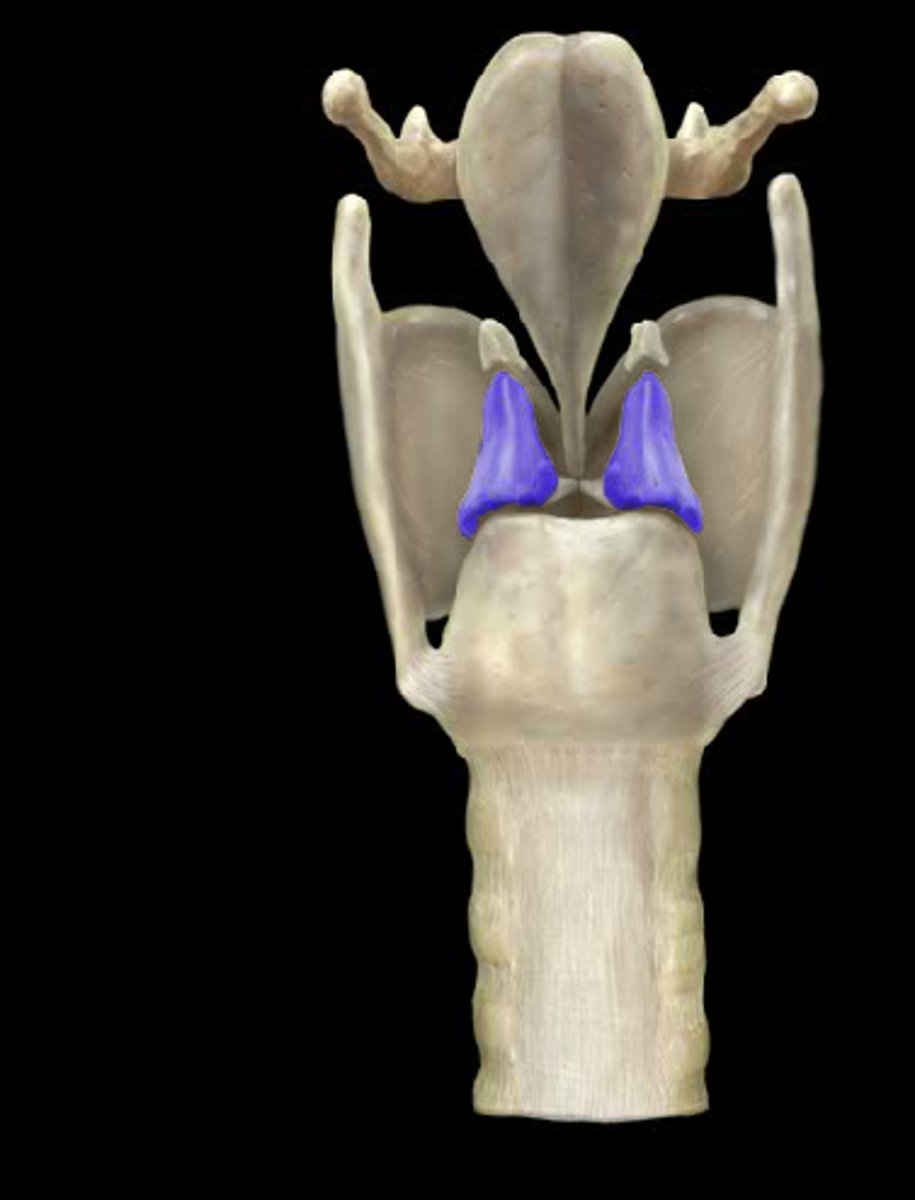 <p>name this</p>