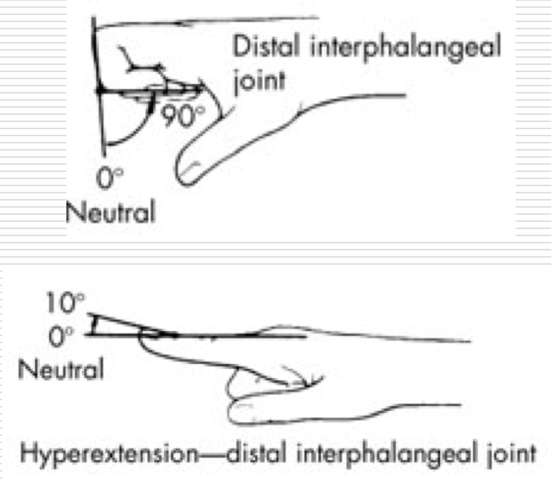 <p>Between middle and distal phalanx </p><p>Ginglymus (hinge)</p><ul><li><p>Flexion / Extension </p></li></ul><p></p>