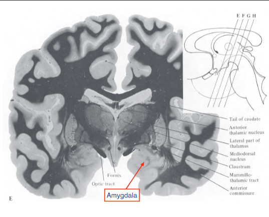 <p>found anteriorly, has a role in conditioning, and has an almond shaped structure</p>