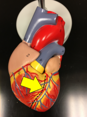 <p>Name the red vessel.</p>