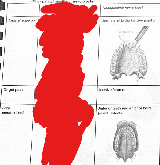 knowt flashcard image