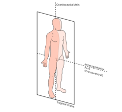 <p>cut made along a longitudinal plane dividing body into right and left parts</p>